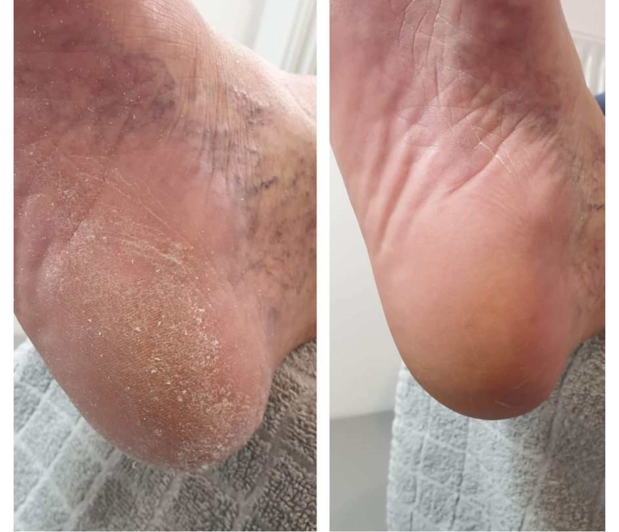Dagelijkse hydratatie mousse 15% ureum - Afbeelding 4